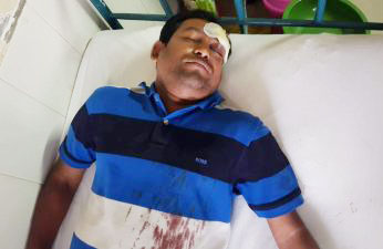 খুলনায় প্রাইম ব্যাংক কর্মকর্তা কর্তৃক বি‌শিষ্ট ব্যবসায়ী জখম