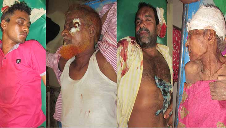 ঝিনাইদহে আ. লীগের দু-গ্রুপের সংঘর্ষে আহত ৪০