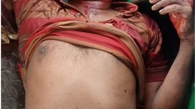 শিরোমণি বাইপাসে অজ্ঞাত ব্যক্তির মৃতদেহ ও মূমুর্ষ অবস্থায় অপর এক ব্যক্তি উদ্ধার