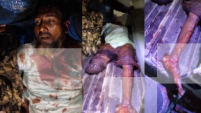 খুলনার দিঘলিয়ায় আ’লীগ কর্মীকে হত্যার পর দুই পা কেটে নিয়েছে সন্ত্রাসীরা