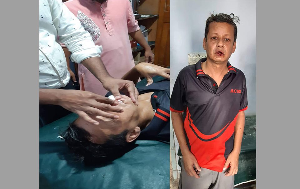 বোন জামাইয়ের অবৈধ সম্পদের তথ্য ফাঁস ও নিজ বাড়ির জন্য বড় ভাইকে হত্যার চেষ্টা মাদকাসক্ত ছোট ভাইর