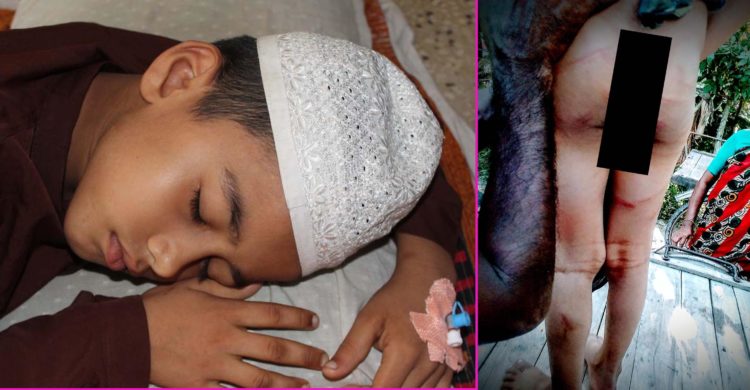 কালেকশনের ১০ টাকা খেয়ে ফেলায় নির্মম নির্যাতন