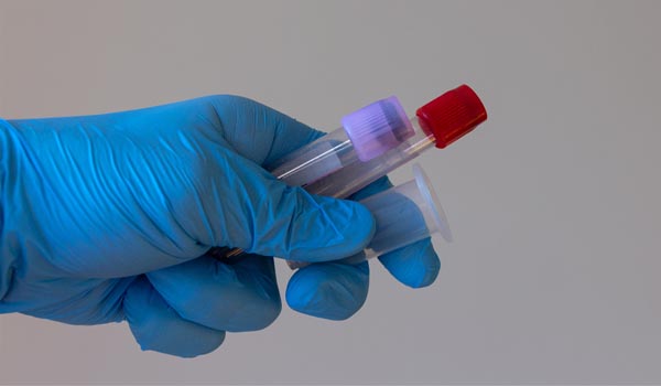 খুলনার সড়ক-মহাসড়কে চালকদের ডোপ টেস্ট কার্যক্রমে ধীরগতি