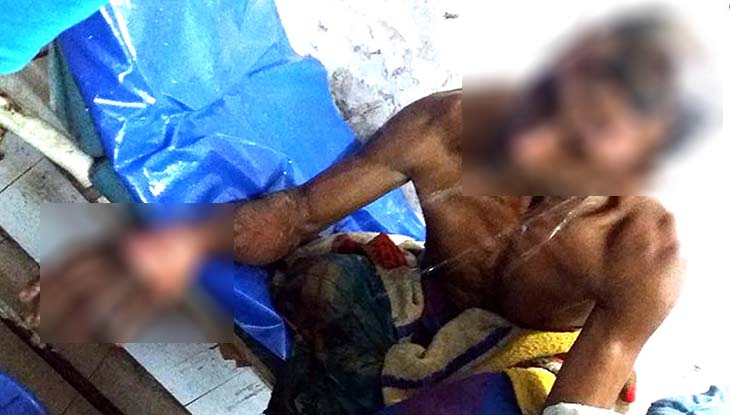 সাতক্ষীরায় কৃষককে জীবন্ত পুড়িয়ে হত্যার চেষ্টা