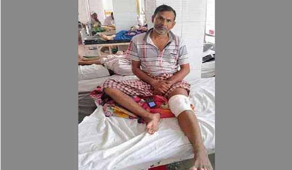 টিউমারের বদলে রোগীর পায়ের হাড় কেটেছেন চিকিৎসক!