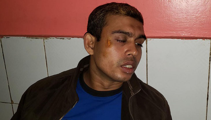 মামলার তদন্তে গিয়ে হামলার শিকার পিবিআই অফিসার