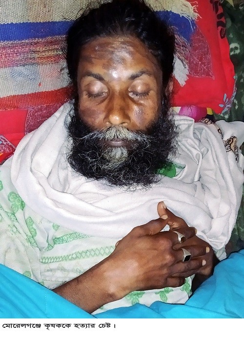 মোরেলগঞ্জে পূর্ব শত্রুতার বিরোধে কৃষককে পিটিয়ে আহত