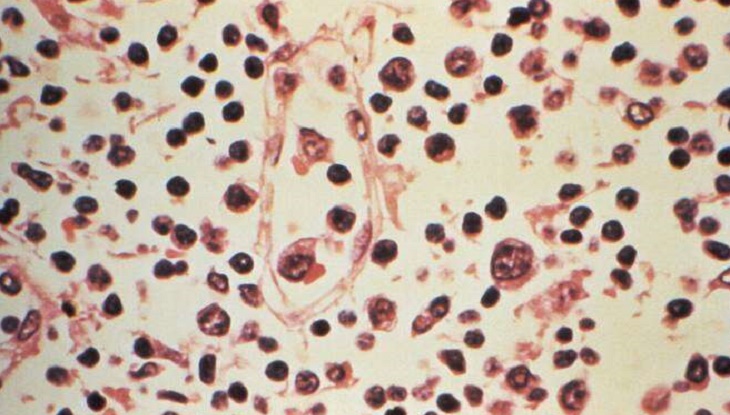 চীনে হান্তা ভাইরাসে মৃত ১, কতটা ভয়াবহ এই ভাইরাস?