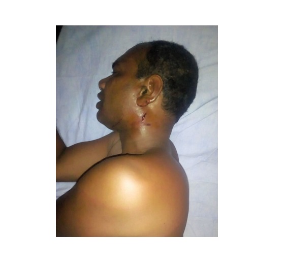 সাংবাদিক আজগরের উপর সন্ত্রাসী হামলা: হাসপাতালে ভর্তি