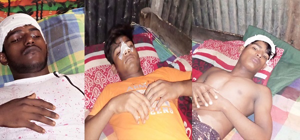 কোটচাঁদপুরে তুচ্ছ ঘটনাকে কেন্দ্র করে তিন যুবককে পিটিয়ে জখম