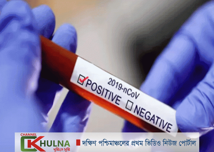 ইউএনওসহ খুলনায় নতুন ২৭জন করোনায় আক্রান্ত