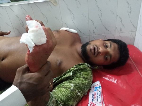 মোংলায় প্রতিপক্ষের হামলায় ইউপি মেম্বরসহ ৫ জন আহত’র ঘটনায় মামলা দায়ের