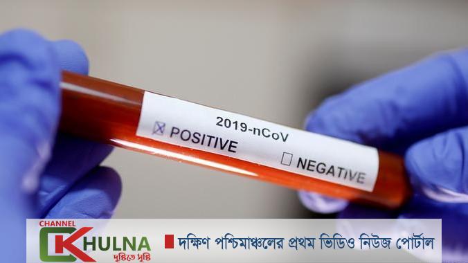 করোনায় ৩৫ জন মৃত্যুর দিনে শনাক্ত ৩,০০৯