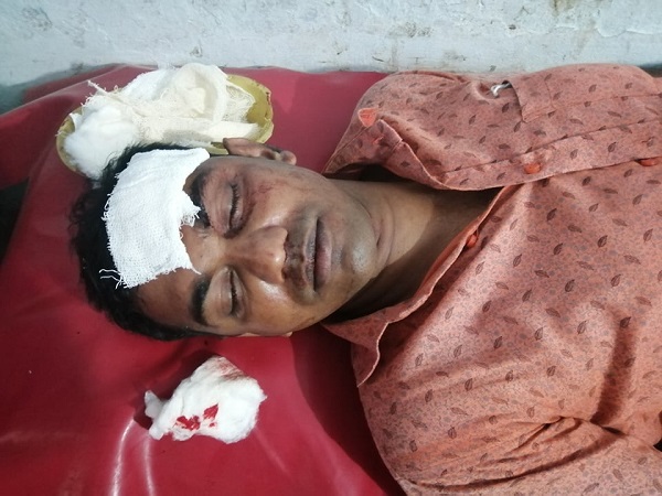 মোড়েলগঞ্জে স্কুল শিক্ষক সহ দু-জনকে কুপিয়ে জখম!