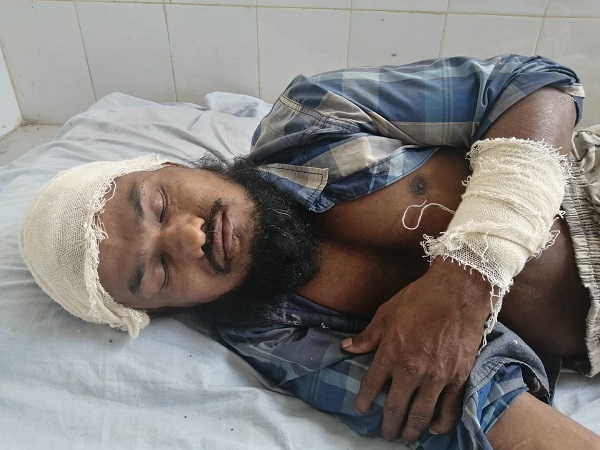 শরণখোলায় প্রতিবন্ধীকে কুপিয়ে জখম!
