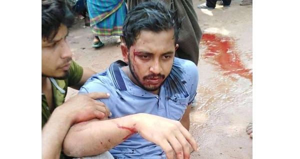 যশোরে সড়ক দুর্ঘটনায় তিনজন আহত