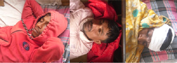 মোড়েলগঞ্জ মৎস্য চুরির অভিযোগে মামলা দায়ের, গণপিটুনিতে আহত-৩,