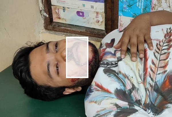 মাদক সেবনে বাধা দেওয়ায় ছাত্রলীগ নেতা লিখনের উপর সন্ত্রাসী হামলা