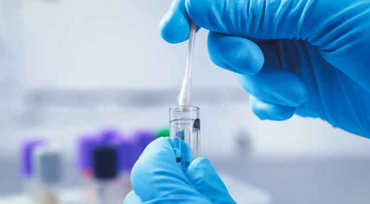 নমুনা পরীক্ষা কম, শনাক্তও কমেছে