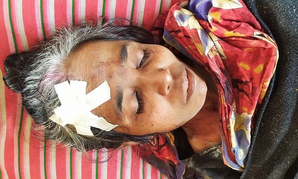 চিতলমারীতে জায়গা নিয়ে বিরোধের জেরে ২ নারী আহত