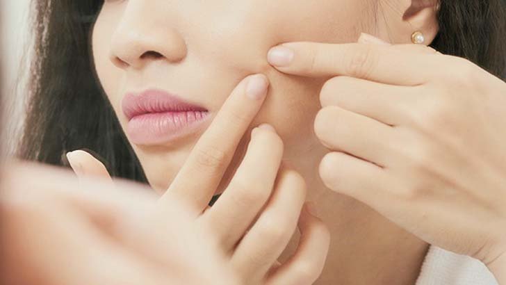 ব্রণ হলে কী করবেন?