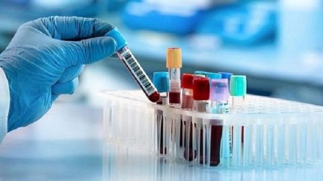 করোনার অ্যান্টিবডি পরীক্ষার অনুমতি দিল সরকার