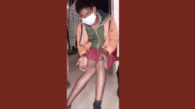 চোর অপবাদে স্কুলছাত্রকে পিটিয়ে হাসপাতালে