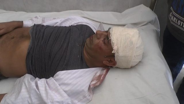 হরিণাকুণ্ডুতে নৌকা প্রতীকের এজেন্টকে কুপিয়ে জখম