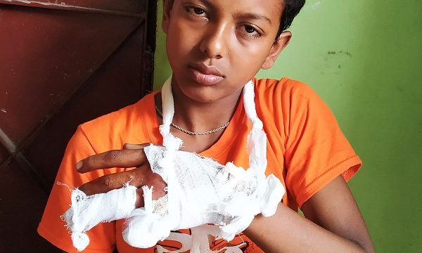 মোরেলগঞ্জে খেলনার বিস্ফোরণে আঙ্গুল উড়ে গেল শিশু মাহিনের