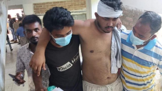 মোংলায় তুচ্ছ ঘটনায় এক দোকানিকে কুপিয়ে জখম করেছে দূর্বত্তরা