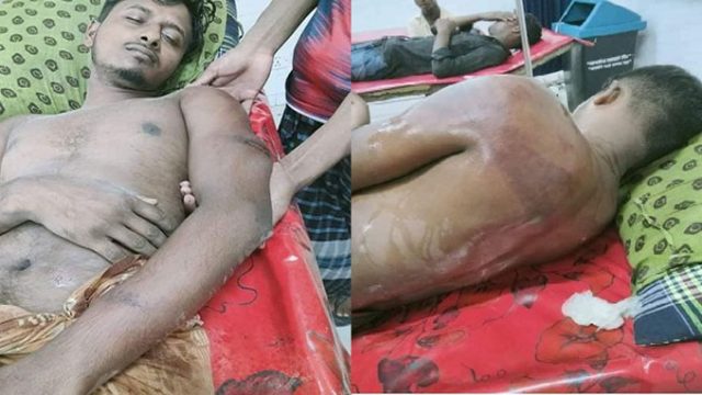 চরফ্যাসনে পূর্ব শত্রুতার জের ধরে যুবককে মধ্যযুগীয় কায়দায় নির্যাতন