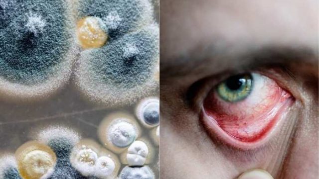 ব্ল্যাক ফাঙ্গাসের ওষুধ নিয়ে স্বাস্থ্য অধিদপ্তরের সতর্কতা