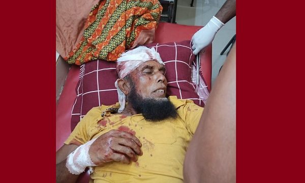 মোল্লাহাটে তুচ্ছ ঘটনায় দু’গ্রামবাসীর সংঘর্ষে আহত ৯