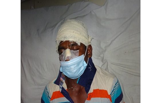 মোরেলগঞ্জে জমি বিরোধে মৎস্য ব্যবসায়ীকে কুপিয়ে জখম