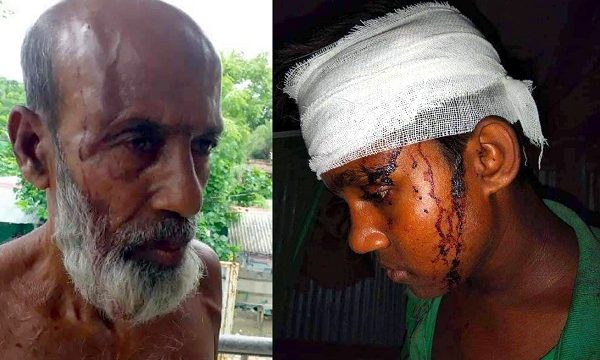 দাকোপে পূর্ব শত্রুতার জেরে হামলা আহত ৩, মামলা হয়নি ৬ দিনেও