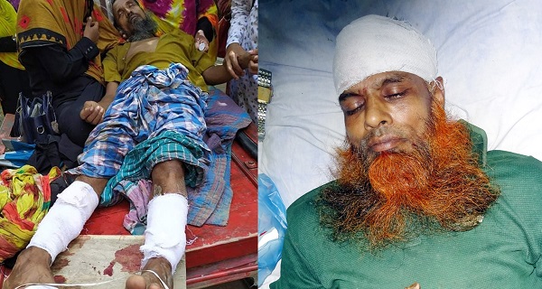 মোরেলগঞ্জে ইউপি মেম্বার প্রার্থীর দু’পা ভেঙ্গে গুড়িয়ে দিয়েছে দুর্বৃত্তরা