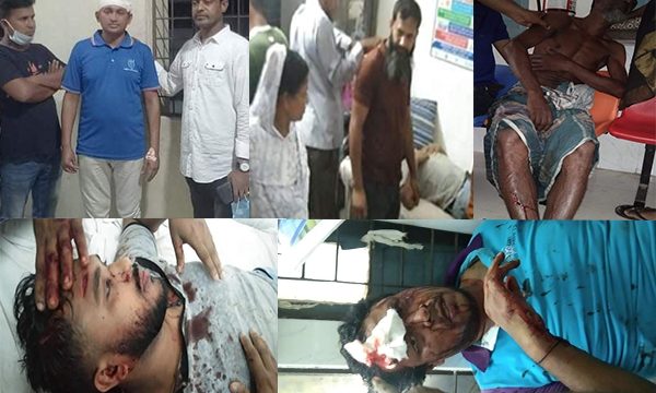 দিঘলিয়ার সেনহাটীতে ইউপি নির্বাচনকে কেন্দ্র করে ২ গ্রুপের সংঘর্ষ আহত কমপক্ষে ৬