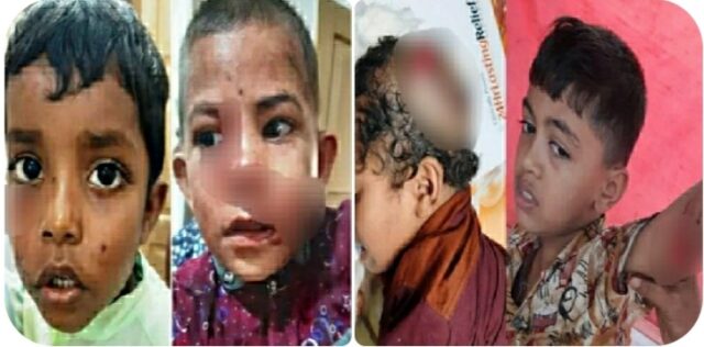 কেশবপুরে কুকুরের কামড়ে ৯ শিশু গুরুতর আহত