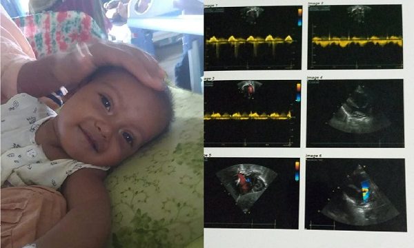 বিড়ল ও জটিল রোগে আক্রান্ত বাচ্চাটির জীবন বাচাতে সহায়তা প্রয়োজন