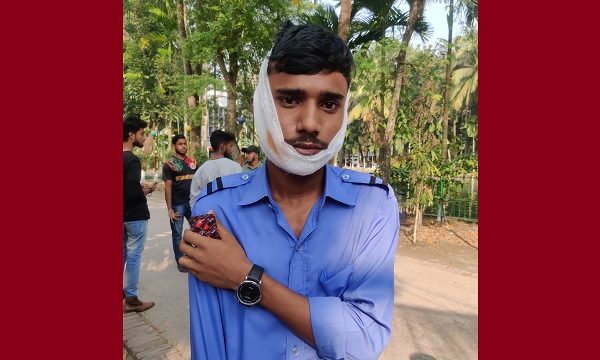 কেপিআইতে শিক্ষক কর্তৃক ছাত্রকে বেধড়ক মারপিট, থানায় অভিযোগ