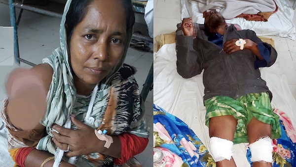 মোরেলগঞ্জে একই পরিবারের ৩ জনকে কুপিয়ে জখম