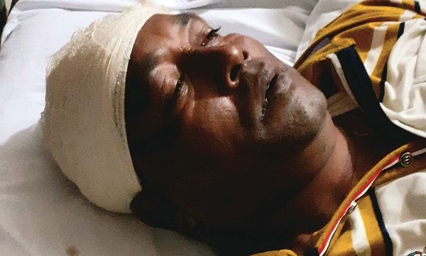 রামপালে ভাগা বাজারে বিল্লাল ব্যাপারীর হামলায় নারী সহ আহত ২,আটক ৮