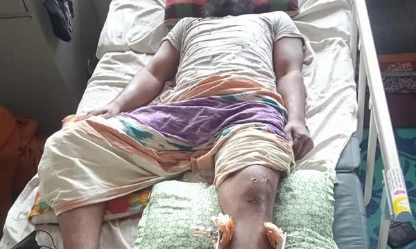 সড়ক দুর্ঘটনায় আহত কোরআনের হাফেজ ও তার বাবার জন্য আর্থিক সাহায্যের আবেদন