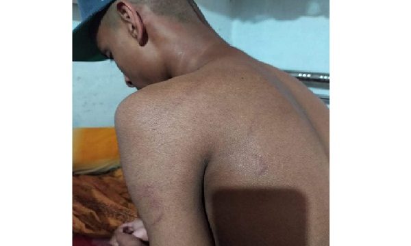 তালায় কলেজ ছাত্রকে ডেকে এনে মারপিট ও মাথা মুন্ড করে দিয়েছে ছাত্রলীগ ও শ্রমিক লীগের নেতা-কর্মীরা