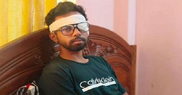 গুলিতে এক চোখের আলো হারিয়েছে শাফিল, দ্বিতীয়টিও নষ্টের পথে