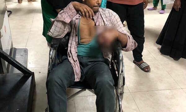 যুবককে বেঁধে নির্যাতন, হাত-পায়ের নখ তুলে ফেলার অভিযোগ নারীর বিরুদ্ধে