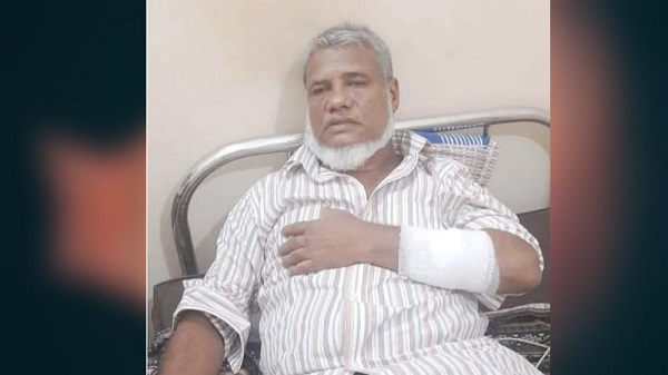 হকিস্টিক দিয়ে পিটিয়ে কৃষক দল নেতার হাত-পা ভেঙে দেওয়ার অভিযোগ প্রতিপক্ষের বিরুদ্ধে