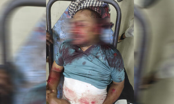 সাবেক যুবদল নেতা মাসুদ ছুরিকাঘাতে গুরুতর আহত