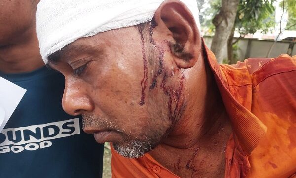 পূর্ব শত্রুতার জেরে দিঘলিয়ার লাখোয়াটীতে ঘের ব্যবসায়ীকে হাতুড়ি দিয়ে পিটিয়ে জখম