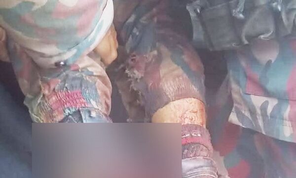 মিয়ানমার সীমান্তে স্থলমাইন বিস্ফোরণে উড়ে গেল বিজিবি সদস্যের পা